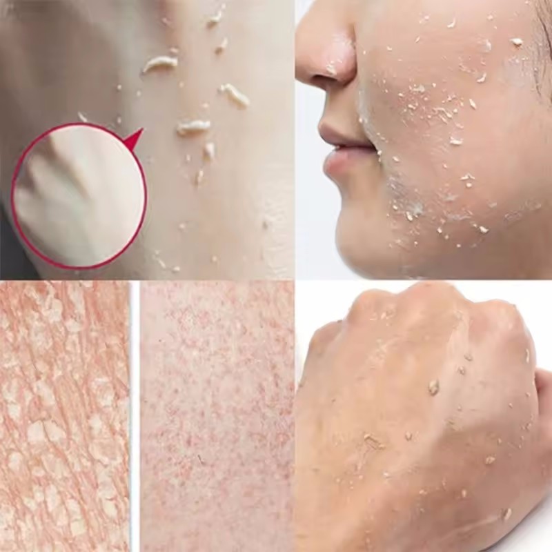 Orange Exfoliating Peeling Gel - Ceramide Moisturizer 评论和价格