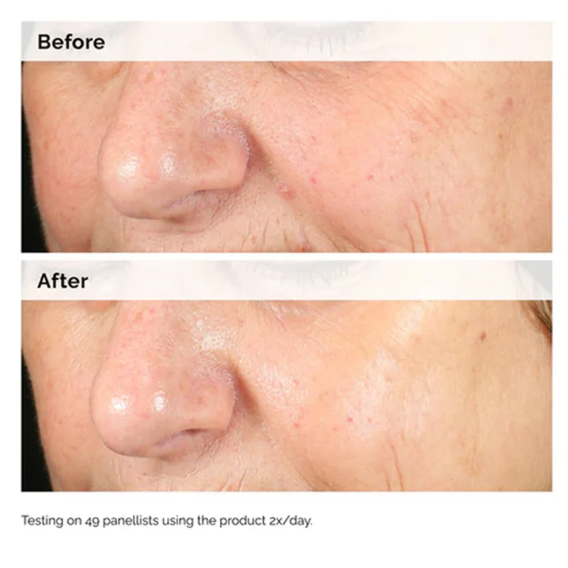 Alpha Arbutin 2% + HA 30ml Ser - Azelaic Acid Serum 评论和价格