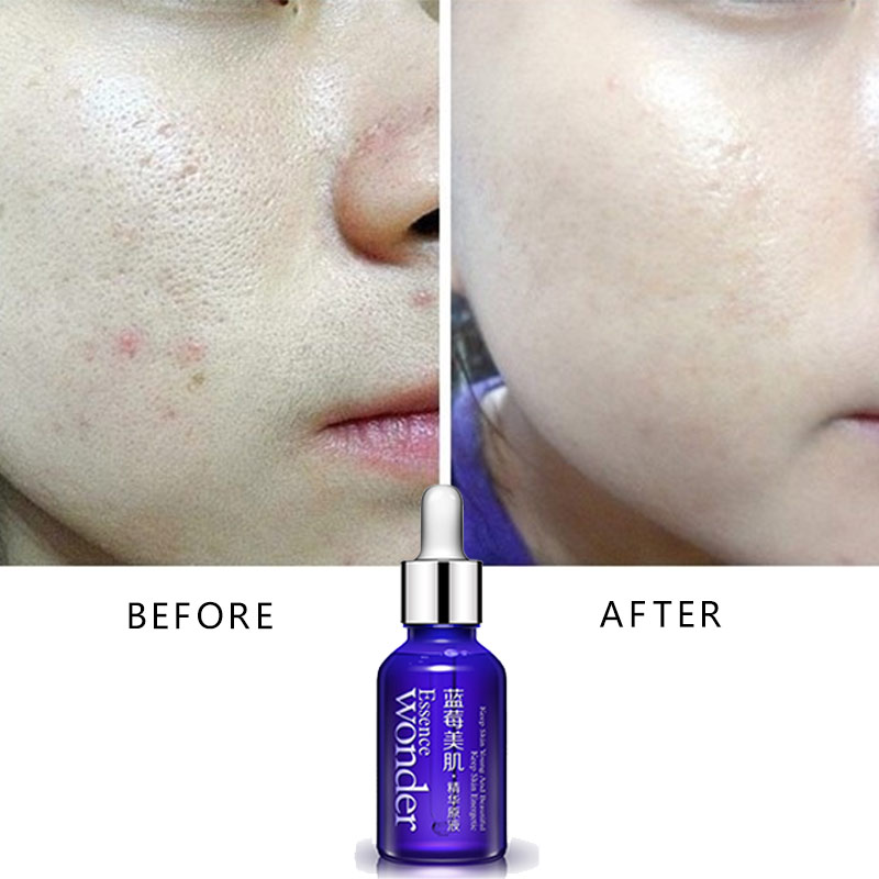 BIOAQUA Blueberry Face Lifting - Skincare Bioaqua 评论和价格