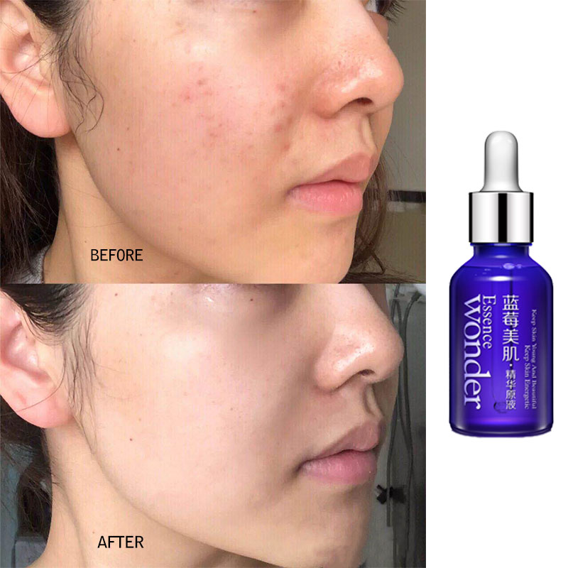BIOAQUA Blueberry Face Lifting - Skincare Bioaqua 评论和价格