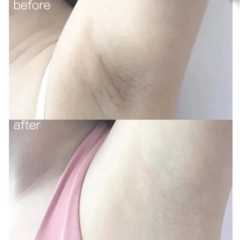 100ml Alpha Arbutin Collagen W - Alpha Arbutin Serum 评论和价格