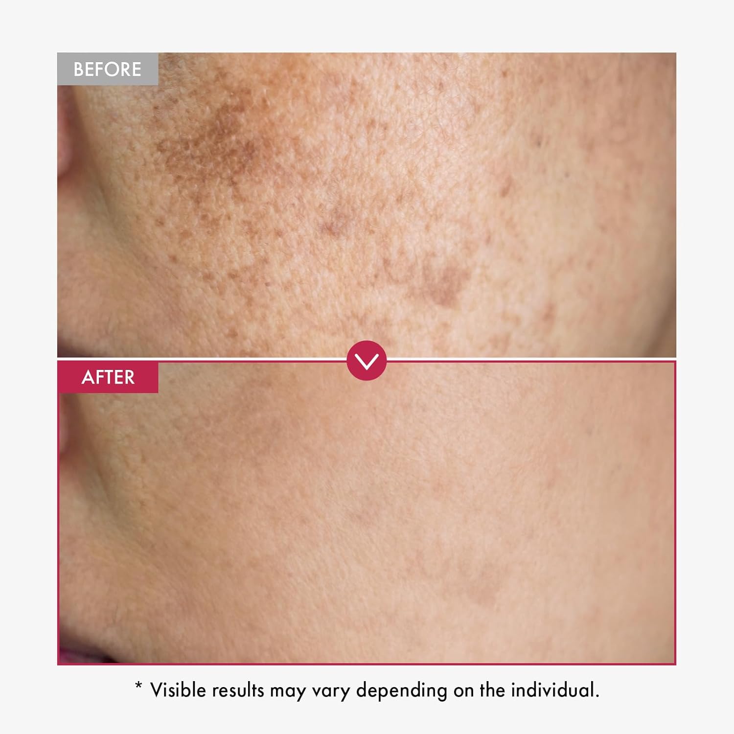 Alpha Arbutin Serum AHA Keeps  - Alpha Arbutin Serum 评论和价格