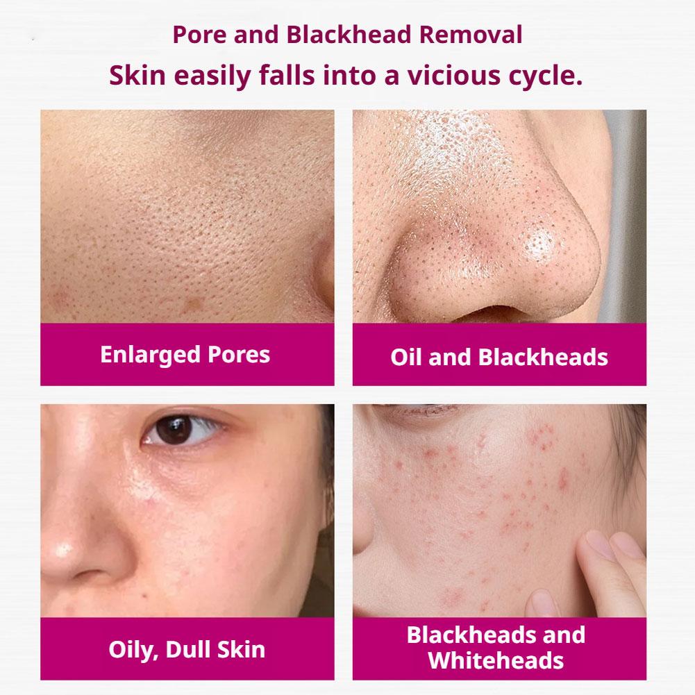 Salicylic Acid Shrink Pores Se - Azelaic Acid Serum 评论和价格