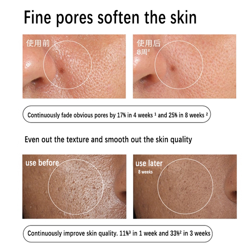 Aloe 2% + NAG 2% Solution Seru - Azelaic Acid Serum 评论和价格