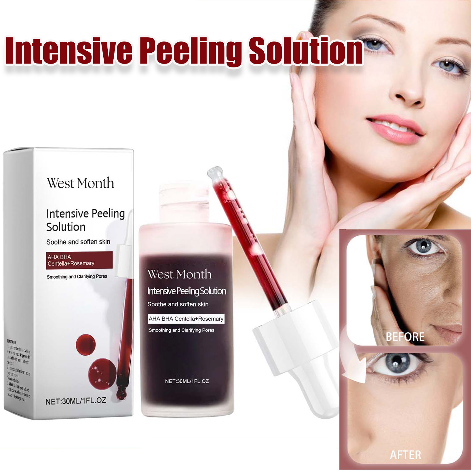 Peeling Face Serum Anti Acne B - Azelaic Acid Serum 评论和价格